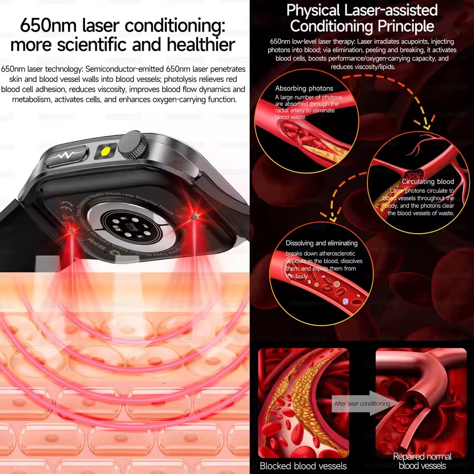 2026년 신형 헬스 스마트워치 레이저 치료로 고혈압, - Industrial Laser Beam 리뷰 및 가격
